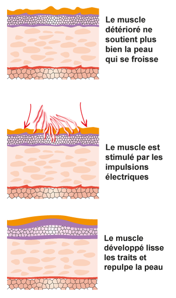 L'électrostimulation en image, par Rio Beauté Principe de l'électrostimulation